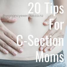 How To Prepare For A C Section Recover From A C Section C Section C Section Recovery Birth Labor