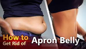Here's what i use and m. How To Get Rid Of Apron Belly Health For Best Life