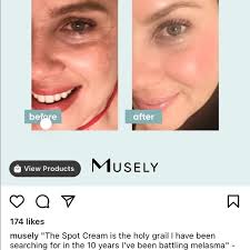 Check spelling or type a new query. Does Musely Spot Cream Work