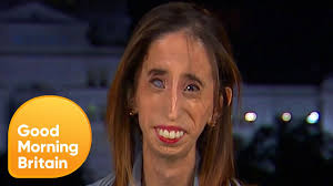 Ever since she was dubbed the world's ugliest woman in a video posted on youtube in 2006, when she was 17, velásquez has spoken out against bullying. Activist Labelled World S Ugliest Woman Reveals How It Changed Her Life Good Morning Britain Youtube