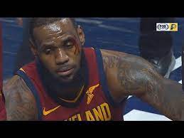 The post lakers' lebron james reveals thumb injury suffered in rockets series appeared first on clutchpoints. Lebron James Injury Eye Injury Cavaliers Vs Pacers Youtube