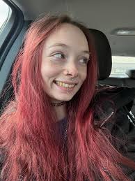 my teeth have never been white, and they never will be. i just have to  learn to accept it at this point. at least im getting somewhere with trying  to take care