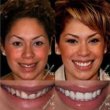 Ramin tabib collaborate to provide you with . World Renowned Cosmetic Dentist Dr Michael Kosdon