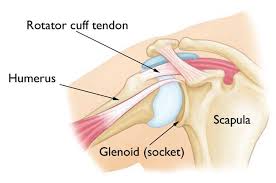The shoulder joint is highly mobile and relies on coordination between various muscles, tendons due to its complex anatomy the shoulder is prone to injuries and to degenerative wear and tear such. Reverse Total Shoulder Replacement Orthoinfo Aaos