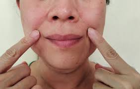 Image result for Physical injury red spots roof of mouth