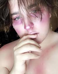 Burna Boy 🖤🖤🖤💯💯💣