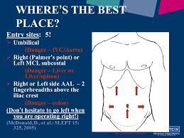 Closed veress entry, especially for patients with prior abdominal operations and intraperitoneal adhesions, to minimize entrance injuries.(4,22) as chung and colleagues suggested, we have been using palmer's point veress needle insertion routinely for upper urinary tract laparoscopy since 2001.(23) palmer's point access is effective and Recognition And Management Of Vascular Injuries Ppt Video Online Download