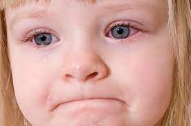 What Are The Best Home Remedies For Pink Eye Lifehack Pinkeye Remedies Pink Eyes Natural Pink Eye Remedy