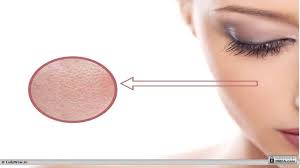 как сузить поры на лице в домашних условиях видео Kak Suzit Pory Na Lice Kosmeticheskie Sredstva I Narodnye Sposoby V Domashnih Usloviyah