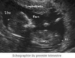 Le fort taux d'hcg permet de maintenir le corps jaune en activité pendant 3 mois et par ce biais, d'assurer la sécrétion de deux hormones essentielles à la grossesse : De 0 A 3 Mois Le Premier Trimestre De La Grossesse Doctissimo