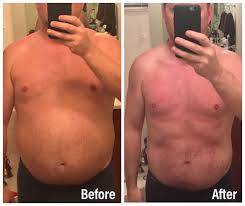 Dallas Hcg Diet And Weight Loss Testimonials