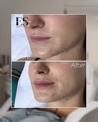 Instagram photo by Dr Eli Shulman • aesthetic & beauty • Dec 10, 2024 at  11:10 PM