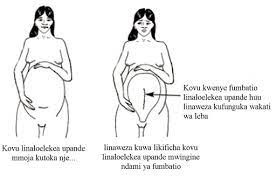 Aina za kuma zinazo pendwa. 2 Kumchunguza Mwanamke Aliye Katika Leba View As Single Page
