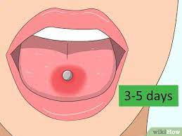 Applying a cold compress twice or thrice on a swollen tongue may help bring down the swelling. 3 Ways To Reduce Tongue Swelling Wikihow