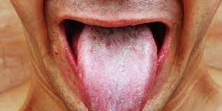 A tongue appears white because of the food debris, dead cells, and bacteria coating it. White Tongue Causes Should You Worry Men S Health