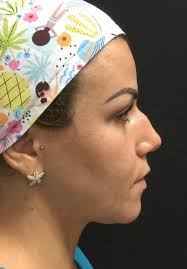 American Legion, stymied by Covid, offering thanks for veterans through  gifts