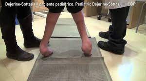 Pre Postoperative Gait In Dejerine Sottas Disease Mov Youtube