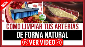 Muchas cremas contra el eccema y medicamentos para el eccema disponibles en el mercado, para un tratamiento efectivo del eccema. Solo Tres Ingredientes Asi De Facil Podras Limpiar Tus Arterias Coronarias Para Ganar Salud Curar Con La Naturaleza Thewikihow
