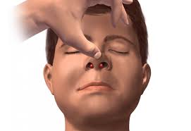 Maybe you would like to learn more about one of these? Septal Hematoma Symptoms Treatments And Causes