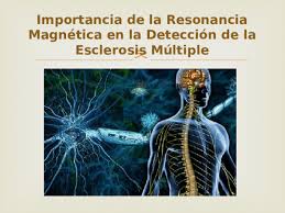 Maybe you would like to learn more about one of these? Ppt Esclerosis Multiple Power Adrian Villavicencio Academia Edu
