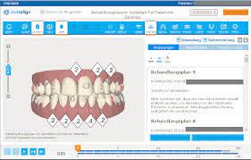 See how invisalign clear aligners can help treat a variety of orthodontic problems including overbites, underbites, crossbites & crowded teeth. Figure 3 From Determining The Forces And Moments Generated By Pet G Thermoplastic Orthodontic Appliances During A Labio Palatal Movement Of An Upper Central Incisor Semantic Scholar