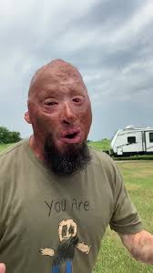 Bobby Henline Staples Has Staples