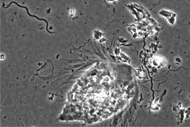 Image result for Treponema