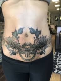 This is me sharing a. What Should You Know Before You Do A Tattoo On A Stretch Mark Part 2