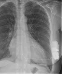(green:title, blue:inclusions, orange:index, red:icd code). Arzte Des Uksh An Hochrangig Publizierter Studie Zu Defibrillatoren Beteiligt