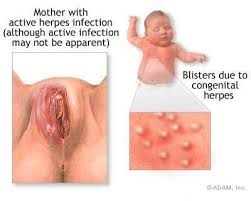 Pin On Nursing Sexually Transmitted Disease Std