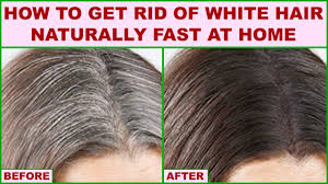 This is because the hair follicles stop producing melanin, the pigment that creates hair color. Medicine For White Hair Problem News And Health