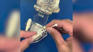 You know what to do! How To Use Temporary Dental Filling Material Youtube