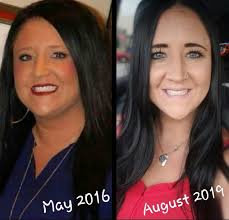 I'm curious as to how many of the contestants have life long lasting health  issues from doing these challenges