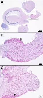 Streptococcus iniae challenge induces minimal acute histopathological  changes in Nile tilapia (Oreochromis niloticus) selectively bred for  disease resistance