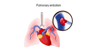 We did not find results for: Hukum Dan Cara Mandi Hadas Selepas Bersalin Jangan Keliru Antara Mandi Wiladah Nifas