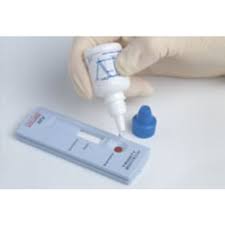 Trinity Biotech Hiv Rapid Test Kit Uni Gold Pk20 1206506 Pack Of 20 Tests Free Shipping Over 49