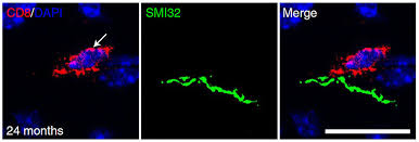 The nervous system has two major parts: Bewn8yo0cpgr0m