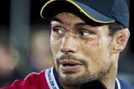 Ex-rugby player Shane Christie, who called for study of concussion, dies at  age 39