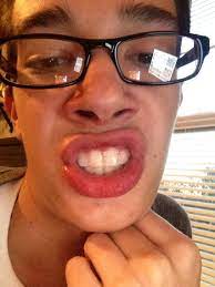 Maybe you would like to learn more about one of these? James Charles On Twitter Note To Self White Strips Taste Absolutely Disgusting Http T Co U6cxboyzbm