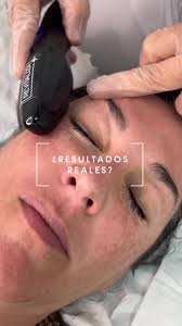 Botofluid Promo VIDEO