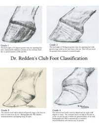 Characteristics of a club foot are a prominent or bulging coronary band, a very. Horse Hoof Irregularities Club Foot Integrity Horse Feed