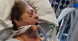 Judge tells robber who beat disabled gran into coma with baseball bat "you  should fear the worst in custody"