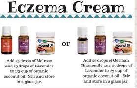 Eczema is considered an immune deficiency and requires a cure to work both inside and out. Eczema Ointment Eczema Cream Essential Oil Recipes Living Essentials Oils