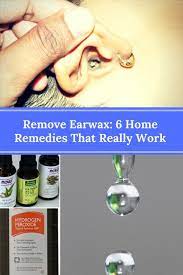 Remove Earwax 6 Home Remedies That Really Work Ear Cleaning Wax Natural Ear Wax Removal Clean Ear Wax Out
