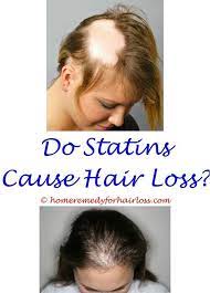 Avoiding Hair Loss After Surgery Enskyce Hair Loss Olive Oil For Hair Loss Men Uv Radiation And Hair Lo Hair Loss Remedies Hair Loss Remedies Women Hair Loss