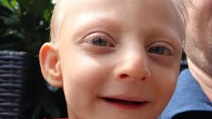 Simone & Jonathan (10): Leben mit einem schwerstbehinderten Kind