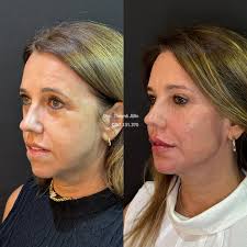 Eles chegaram cheios de dúvidas, medos e inseguranças… Hoje, saem daqui com  brilho no olhar, agenda em movimento e o coração cheio de propósito. 💫 A  Mentoria VIP é sobre técnica, sim…