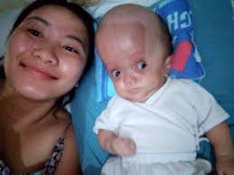 Hi po ask ko lang po if pwede po ito kay baby g6pd?