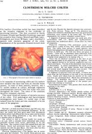 Infant botulism (a48.51) wound botulism (a48.52) a05.2 foodborne clostridium perfringens clostridium welchii intoxication. Clostridium Welchii Colitis Tate 1965 Bjs British Journal Of Surgery Wiley Online Library
