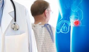 Burning or pain during urination. Prostate Cancer Symptoms Doctors Tests For Disease Revealed Express Co Uk